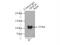 DEAD-Box Helicase 20 antibody, 11324-1-AP, Proteintech Group, Immunoprecipitation image 