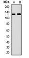 Putative rRNA methyltransferase 3 antibody, LS-C668314, Lifespan Biosciences, Western Blot image 