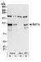 BAF Chromatin Remodeling Complex Subunit BCL11A antibody, A300-381A, Bethyl Labs, Western Blot image 