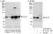 Exocyst Complex Component 7 antibody, A303-365A, Bethyl Labs, Immunoprecipitation image 