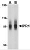 SP110 Nuclear Body Protein antibody, 4409, ProSci, Western Blot image 