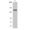Collagen alpha-3(IV) chain antibody, LS-C380489, Lifespan Biosciences, Western Blot image 