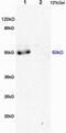 SCARA1 antibody, GTX51749, GeneTex, Western Blot image 