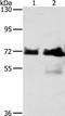B-Raf Proto-Oncogene, Serine/Threonine Kinase antibody, TA321643, Origene, Western Blot image 