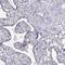 Kinesin Family Member 19 antibody, PA5-67284, Invitrogen Antibodies, Immunohistochemistry paraffin image 