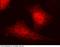 Cyclin A2 antibody, 101197-T38, Sino Biological, Immunohistochemistry paraffin image 