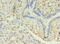 Dopamine Receptor D5 antibody, CSB-PA007182EA01HU, Cusabio, Immunohistochemistry paraffin image 