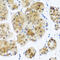RAD23 Homolog B, Nucleotide Excision Repair Protein antibody, 13-590, ProSci, Immunohistochemistry paraffin image 