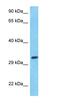 Mitochondrial Ribosomal Protein L19 antibody, orb327307, Biorbyt, Western Blot image 
