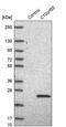 Chromosome 10 Open Reading Frame 55 antibody, PA5-61085, Invitrogen Antibodies, Western Blot image 
