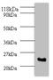 Serine And Arginine Rich Splicing Factor 9 antibody, A51472-100, Epigentek, Western Blot image 
