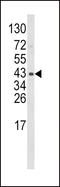 Wnt Family Member 5B antibody, LS-C160635, Lifespan Biosciences, Western Blot image 