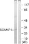 Secretory carrier-associated membrane protein 1 antibody, A08692, Boster Biological Technology, Western Blot image 