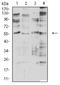 Cholinergic Receptor Nicotinic Alpha 2 Subunit antibody, NBP2-61667, Novus Biologicals, Western Blot image 