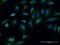 Translocated Promoter Region, Nuclear Basket Protein antibody, H00007175-M05, Novus Biologicals, Immunofluorescence image 