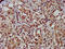 Transcription Factor B1, Mitochondrial antibody, CSB-PA023420LA01HU, Cusabio, Immunohistochemistry paraffin image 