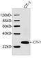 Cardiotrophin-1 antibody, LS-C203224, Lifespan Biosciences, Western Blot image 