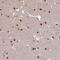 Suppression Of Tumorigenicity 5 antibody, PA5-61331, Invitrogen Antibodies, Immunohistochemistry frozen image 