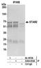 Signal Transducing Adaptor Molecule 2 antibody, A304-818A, Bethyl Labs, Immunoprecipitation image 