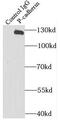 Cadherin 3 antibody, FNab06187, FineTest, Immunoprecipitation image 