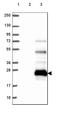 Transmembrane Protein 52B antibody, HPA058096, Atlas Antibodies, Western Blot image 