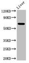 Sentrin-specific protease 2 antibody, LS-C672133, Lifespan Biosciences, Western Blot image 