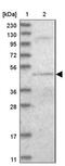 DALR Anticodon Binding Domain Containing 3 antibody, NBP1-84622, Novus Biologicals, Western Blot image 