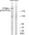 ITGB4 antibody, TA314097, Origene, Western Blot image 