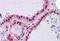 Hepcidin Antimicrobial Peptide antibody, MBS246270, MyBioSource, Immunohistochemistry paraffin image 