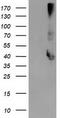 Microtubule-associated protein RP/EB family member 2 antibody, CF502961, Origene, Western Blot image 