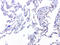 DNA excision repair protein ERCC-1 antibody, LS-C800181, Lifespan Biosciences, Immunohistochemistry paraffin image 