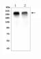 Acetyl-CoA carboxylase 2 antibody, A03668-2, Boster Biological Technology, Western Blot image 