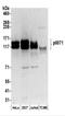Plakophilin 4 antibody, NBP2-37691, Novus Biologicals, Western Blot image 