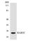 RAB5C, Member RAS Oncogene Family antibody, LS-C200554, Lifespan Biosciences, Western Blot image 