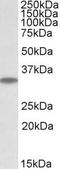 Microtubule-associated protein RP/EB family member 3 antibody, TA311402, Origene, Western Blot image 