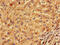 Kelch Like Family Member 2 antibody, CSB-PA012421LA01HU, Cusabio, Immunohistochemistry paraffin image 