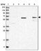 Ral GEF With PH Domain And SH3 Binding Motif 2 antibody, NBP1-84645, Novus Biologicals, Western Blot image 