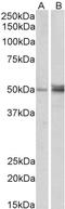 Forkhead Box L2 antibody, TA302879, Origene, Western Blot image 