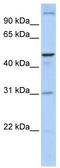 Acyl-CoA Binding Domain Containing 5 antibody, TA335955, Origene, Western Blot image 