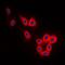 Microtubule Associated Protein Tau antibody, orb214229, Biorbyt, Immunofluorescence image 
