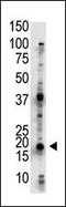 Ubiquitin-conjugating enzyme E2 G2 antibody, 61-085, ProSci, Western Blot image 