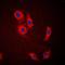 Solute Carrier Family 24 Member 1 antibody, orb214876, Biorbyt, Immunocytochemistry image 