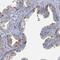Zinc Finger Protein 852 antibody, PA5-62076, Invitrogen Antibodies, Immunohistochemistry paraffin image 