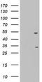3-Oxoacyl-ACP Synthase, Mitochondrial antibody, TA802185, Origene, Western Blot image 