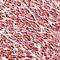 Desmin antibody, LS-C88748, Lifespan Biosciences, Immunohistochemistry paraffin image 