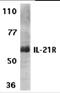 Interleukin 21 Receptor antibody, 2471, ProSci Inc, Western Blot image 