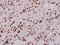 Neutrophil Cytosolic Factor 1 antibody, A01586-2, Boster Biological Technology, Immunohistochemistry paraffin image 