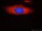 Staphylococcal Nuclease And Tudor Domain Containing 1 antibody, 60265-1-Ig, Proteintech Group, Immunofluorescence image 