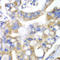 Pancreatic Lipase antibody, LS-C349125, Lifespan Biosciences, Immunohistochemistry paraffin image 