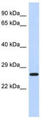EF-Hand Domain Family Member D2 antibody, TA344264, Origene, Western Blot image 